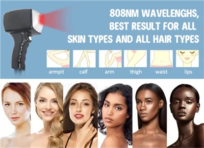 Quel laser est le meilleur pour l’épilation ?