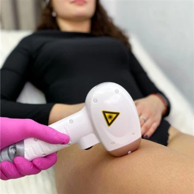 Qu'est-ce que la machine d'épilation au laser à diode ?